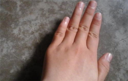 女人手指粗短代表什么 手指短粗的女人命运