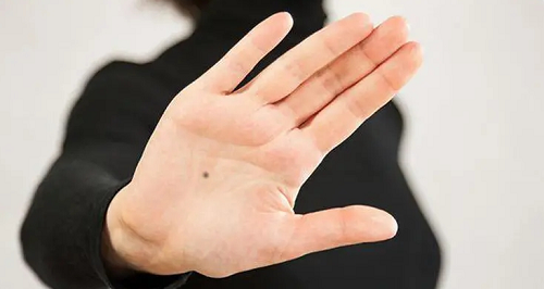 手掌心有痣的女人代表什么意思 女性右手掌心有痣