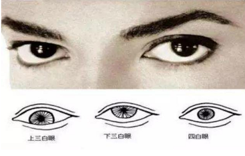 三白眼的女人面相分析 三白眼的女人面相很凶