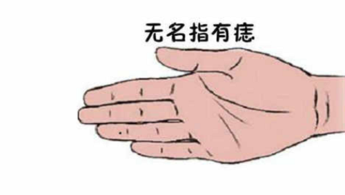 左手无名指有痣的女人代表什么 左手无名指有痣的女人是婚姻不顺吗